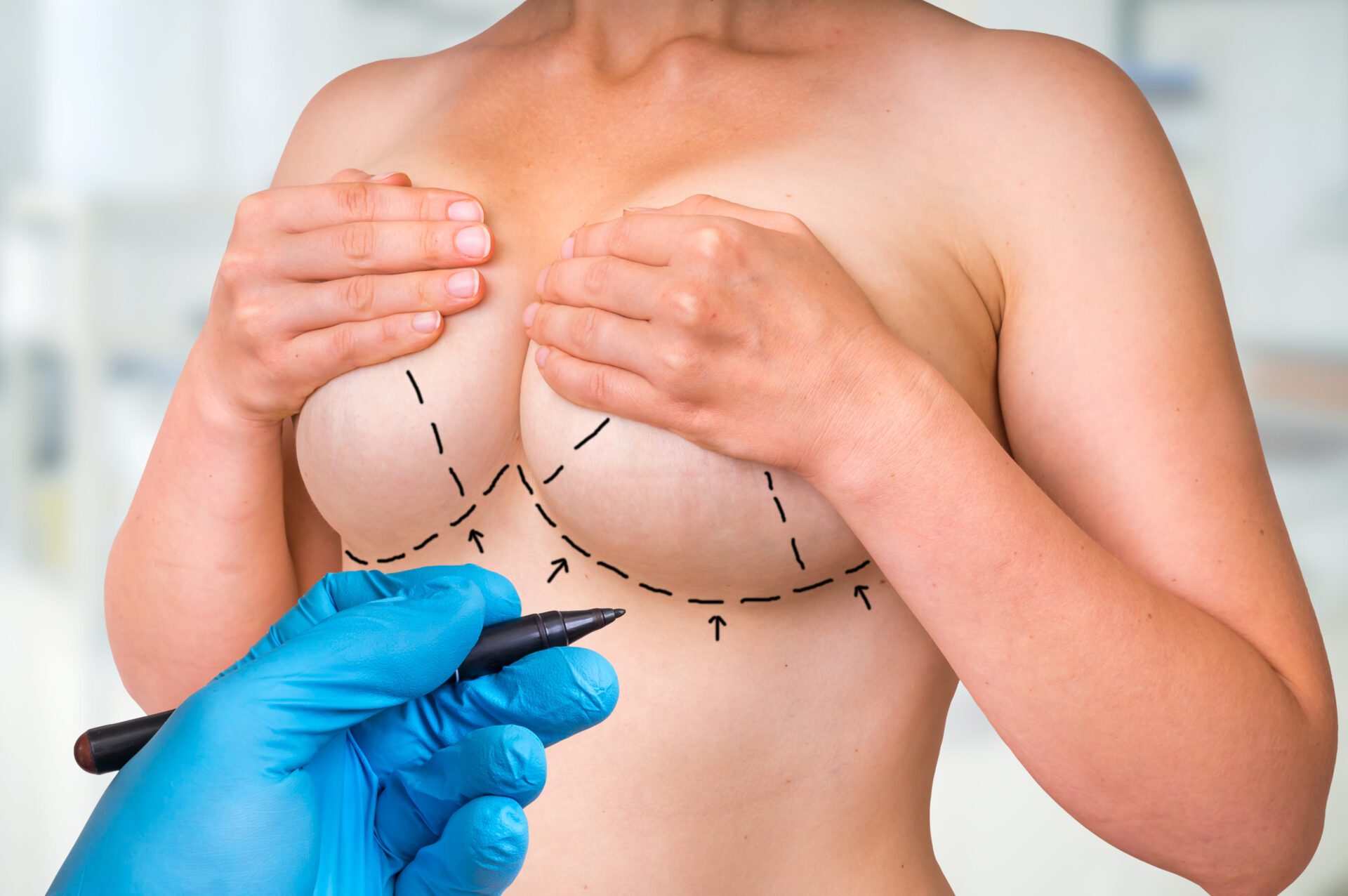 Female breast marked with lines for breast cancer awareness. Doctor examining female breast.